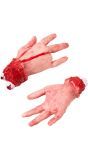 Afgesneden hand met afgehakte vinger